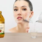 Hoe appelazijn te gebruiken om rimpels te verwijderen en expressielijnen snel te verzachten